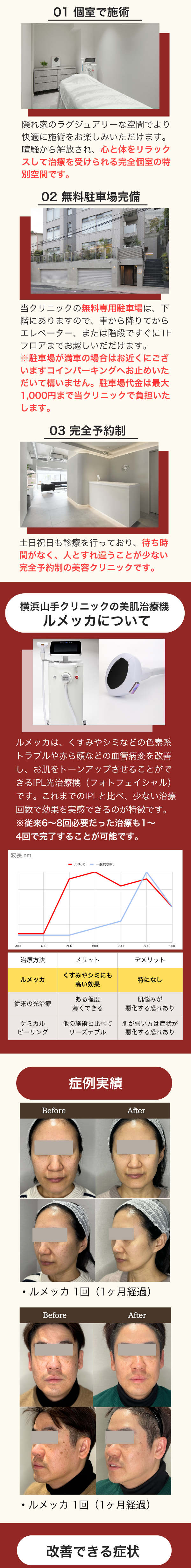 シミ