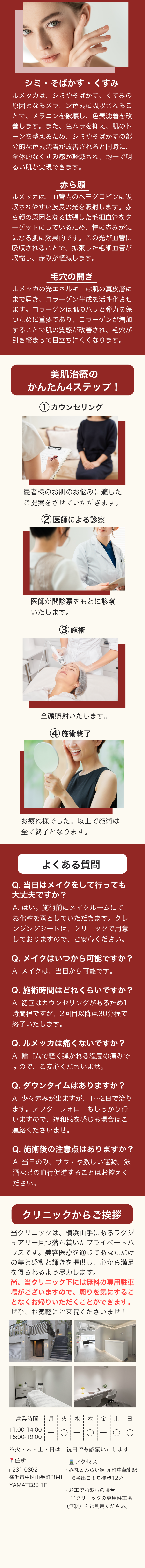 シミ