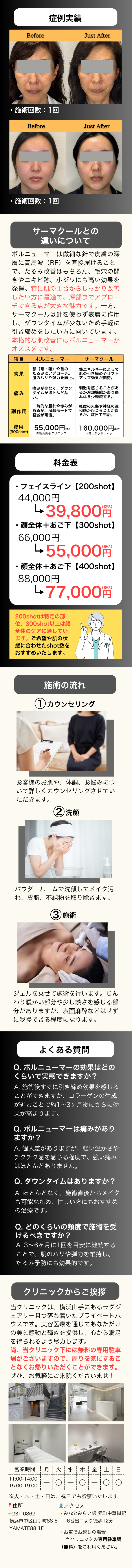 ボルニューマー
